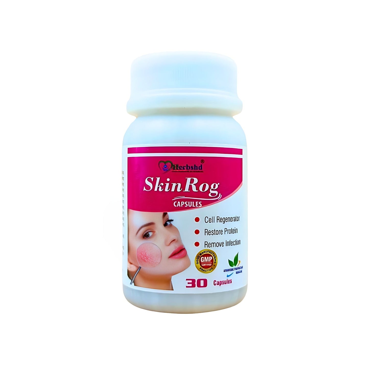 Ayurvedic Skin Rog 30'Capsules